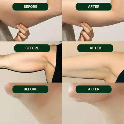 Gloar Lymphatic Drainage - Detox & De-Bloat in Days