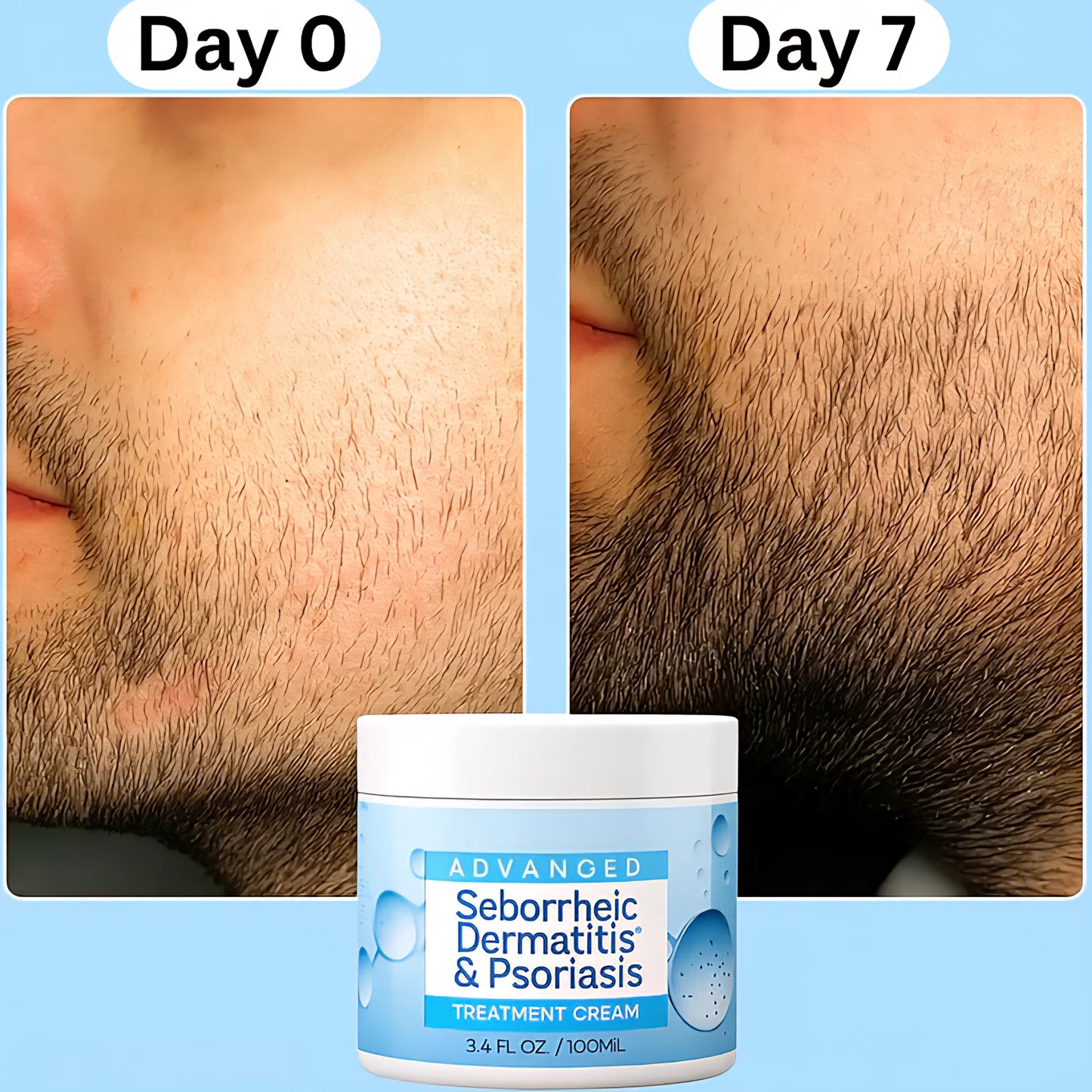 CalmSkin Balm